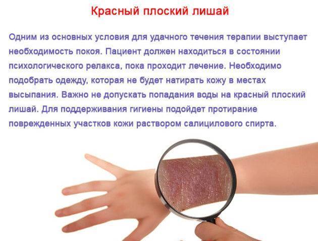 Как выглядит сыпь лишая